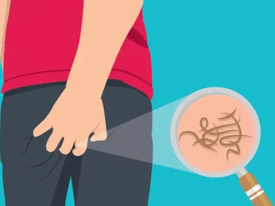 Parasit Cacing Pada Manusia Yang Berdampak Buruk