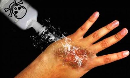 Cairan Kimia Air Keras Di Lakukan Untuk Hal Negatif