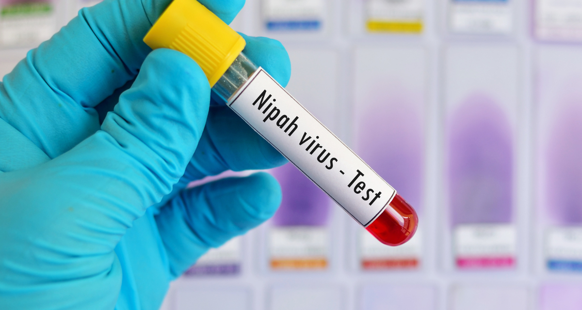 Virus Nipah Renggut Nyawa Wanita Di Bangladesh