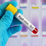 Virus Nipah Renggut Nyawa Wanita Di Bangladesh