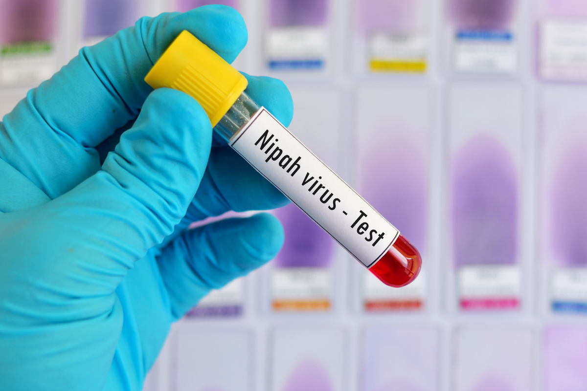 Virus Nipah Renggut Nyawa Wanita Di Bangladesh