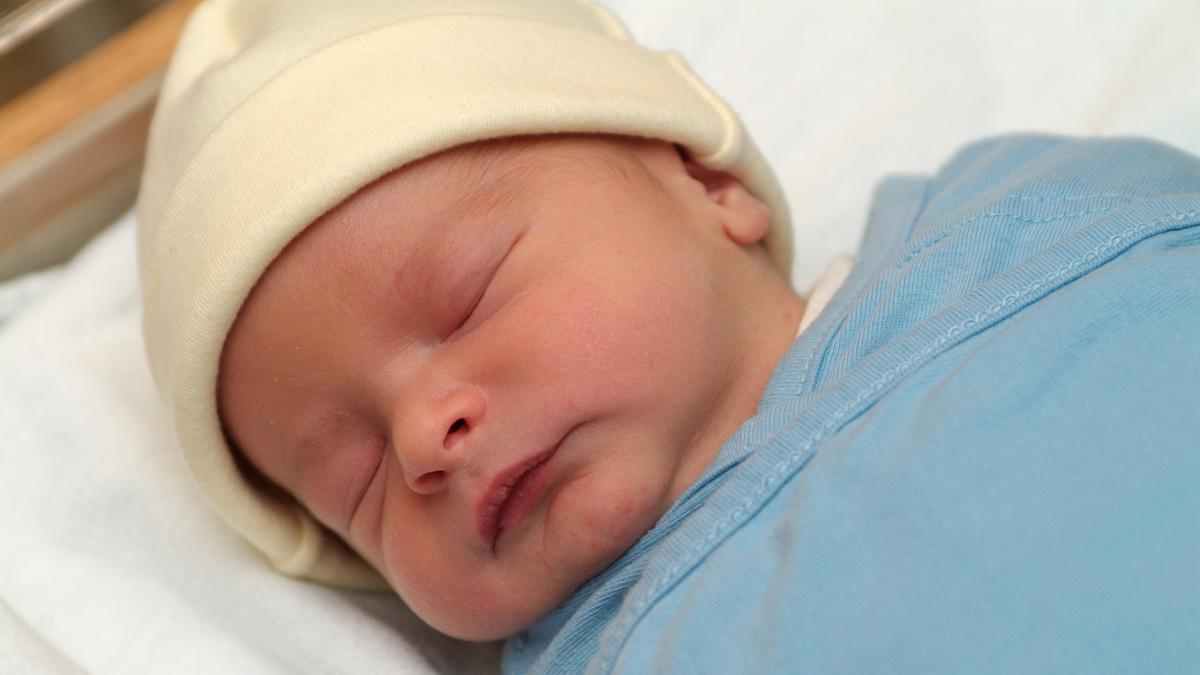 Pemicu Bayi Kuning & Cara Mengatasinya